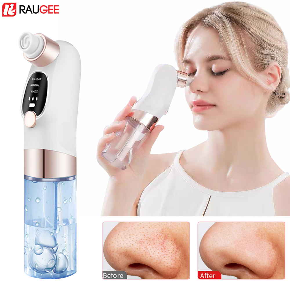 Extractor de espinillas eléctr - Air Bubble Remover reseña y precio