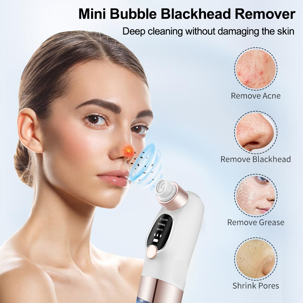 Extractor de espinillas eléctr - Air Bubble Remover reseña y precio